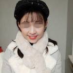 广州优雅联合口腔门诊部孙风阳牙齿矫正案例分享