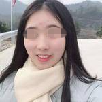 重庆新桥医院口腔科张纲牙齿矫正案例