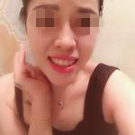 重庆新桥医院口腔科方晓琴牙齿矫正案例分享