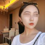 北京佳美口腔医院滕飞宇牙齿矫正案例