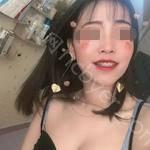 武汉仁爱口腔医院潘少群牙齿矫正案例