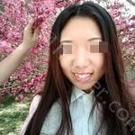 武汉德韩口腔医院杜静婷牙齿矫正案例
