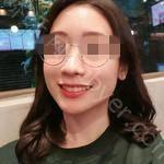 武汉存济口腔医院王瑞端牙齿矫正案例展示