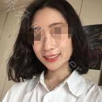 武汉存济口腔医院王瑞端牙齿矫正案例展示