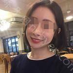 武汉存济口腔医院王瑞端牙齿矫正案例展示