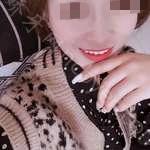 武汉市清华阳光口腔医院李胜锐牙齿美白案例展示