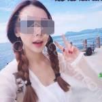 武汉存济口腔医院黄春梅牙齿矫正案例展示