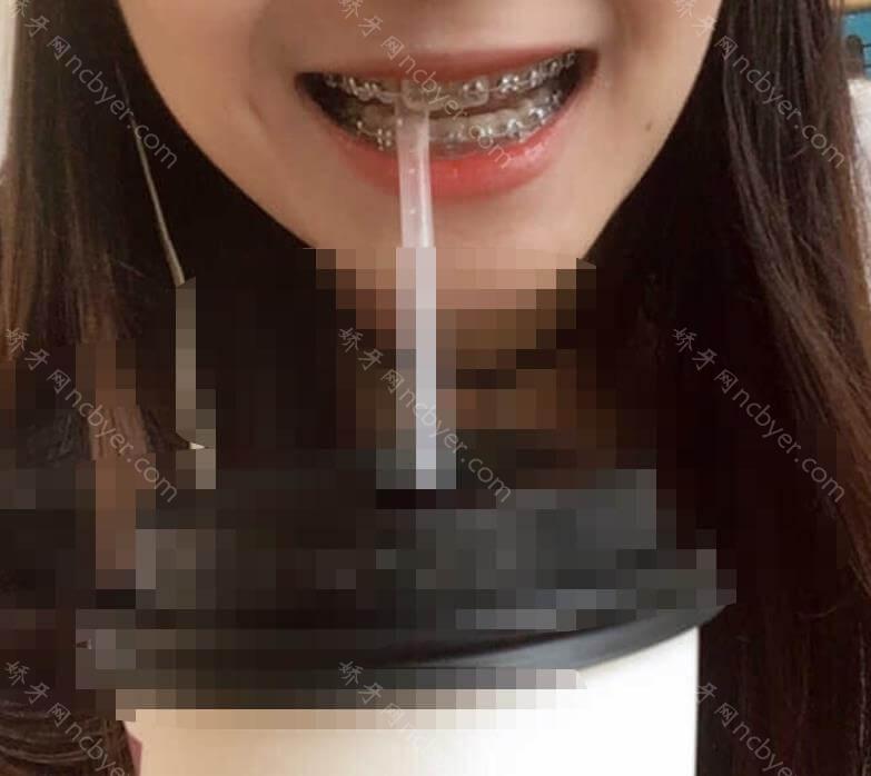 杭州余杭口腔医院宋宇涵怎么样？简介_案例介绍