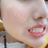 西安时代口腔杜园园怎么样？简介_预约咨询