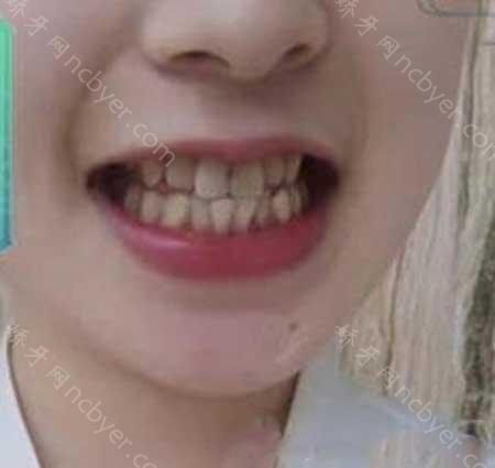 西安画美团圆口腔门诊部李永峰怎么样？简介_预约咨询