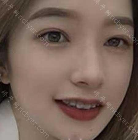西安画美团圆口腔门诊部李永峰怎么样？简介_预约咨询