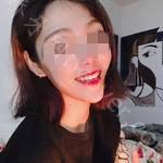 武汉华美口腔医院王守文牙齿矫正案例展示