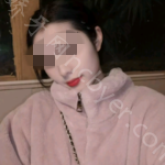 武汉大众口腔医院秦烦牙齿贴面案例
