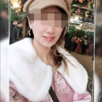 武汉大众口腔医院秦烦牙齿贴面案例