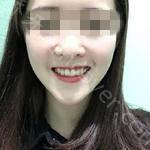 武汉大众口腔医院王小永牙齿矫正案例