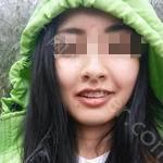 武汉大众口腔医院肖忠吉牙齿矫正案例