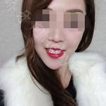 武汉同济医院口腔科马净植牙齿美白案例分享