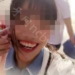 武汉第一口腔医院许庆安牙齿矫正案例