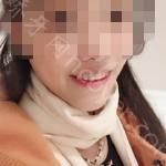 武汉第一口腔医院许庆安牙齿矫正案例