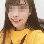 武汉咿呀口腔医院沈真祥牙齿矫正案例分享