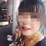 武汉咿呀口腔医院黄涛牙齿美白案例分享