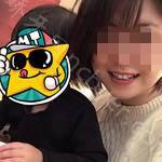 武汉咿呀口腔医院黄涛牙齿美白案例分享