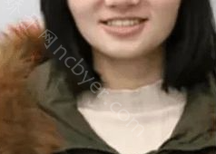 长沙市第一医院口腔科邹毅军牙齿矫正案例展示
