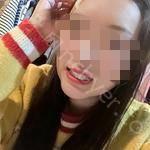 武汉咿呀口腔医院李筱牙齿矫正案例