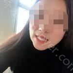 武汉咿呀口腔医院李筱牙齿矫正案例