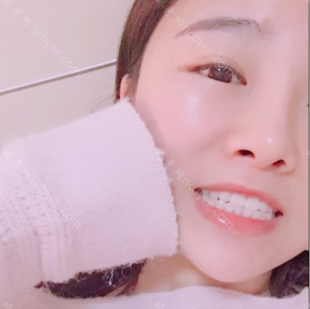 厦门亚欧口腔门诊部欧忠辉牙齿矫正展示