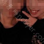 武汉博雅口腔医院孙凤颜牙齿矫正案例分享
