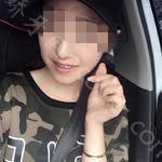 武汉博雅口腔医院孙凤颜牙齿矫正案例分享