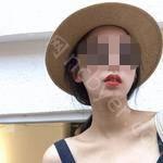 武汉博雅口腔医院叶璐牙齿矫正案例分享