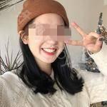 武汉博雅口腔医院叶璐牙齿矫正案例分享