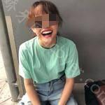 武汉博雅口腔医院关忠玉牙齿贴面真实分享