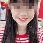 武汉博雅口腔医院关忠玉牙齿贴面真实分享