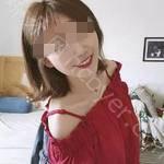 武汉爱齿尔口腔医院田虎牙齿矫正案例分享