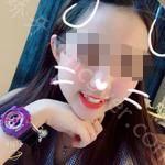 武汉爱齿尔口腔医院徐安斌牙齿矫正案例分享
