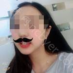 武汉爱齿尔口腔医院徐安斌牙齿矫正案例分享