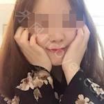 武汉牙达人口腔医院胡仲恒牙齿矫正案例分享