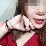 武汉牙达人口腔医院胡仲恒牙齿矫正案例分享