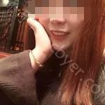 武汉牙达人口腔医院胡仲恒牙齿矫正案例分享
