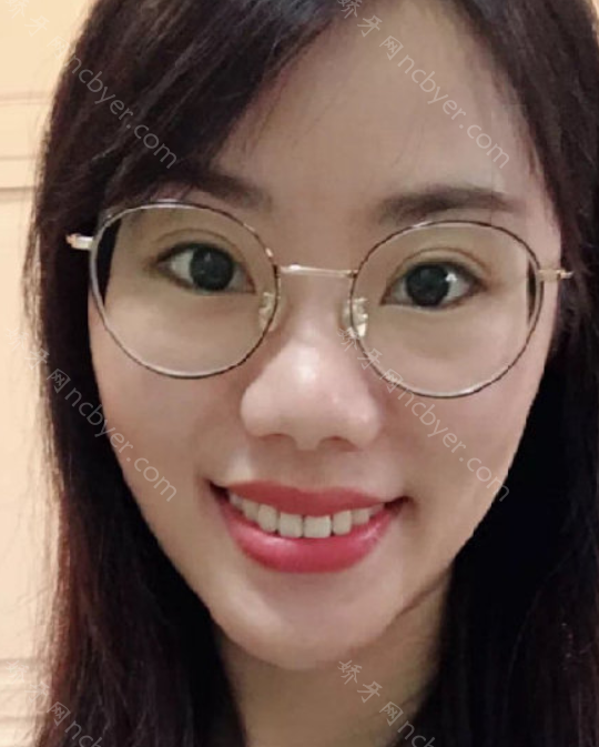 厦门登特口腔林军龙牙齿矫正案例展示