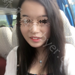 武汉康承贝健口腔医院姜海波牙齿矫正案例分享