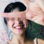 武汉固齐口腔医院叶翁三杰全瓷烤瓷牙案例分享