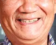 重庆市巴南区人民医院口腔科杨清牙齿种植真实案例分享