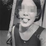 武汉达美口腔医院卢晓彦牙齿矫正案例分享