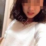 武汉达美口腔医院程浩牙齿贴面案例分享
