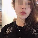 武汉冠美口腔医院李德龙医生牙齿美白案例分享