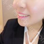 武汉冠美口腔医院贺纪良医生牙齿美白案例分享